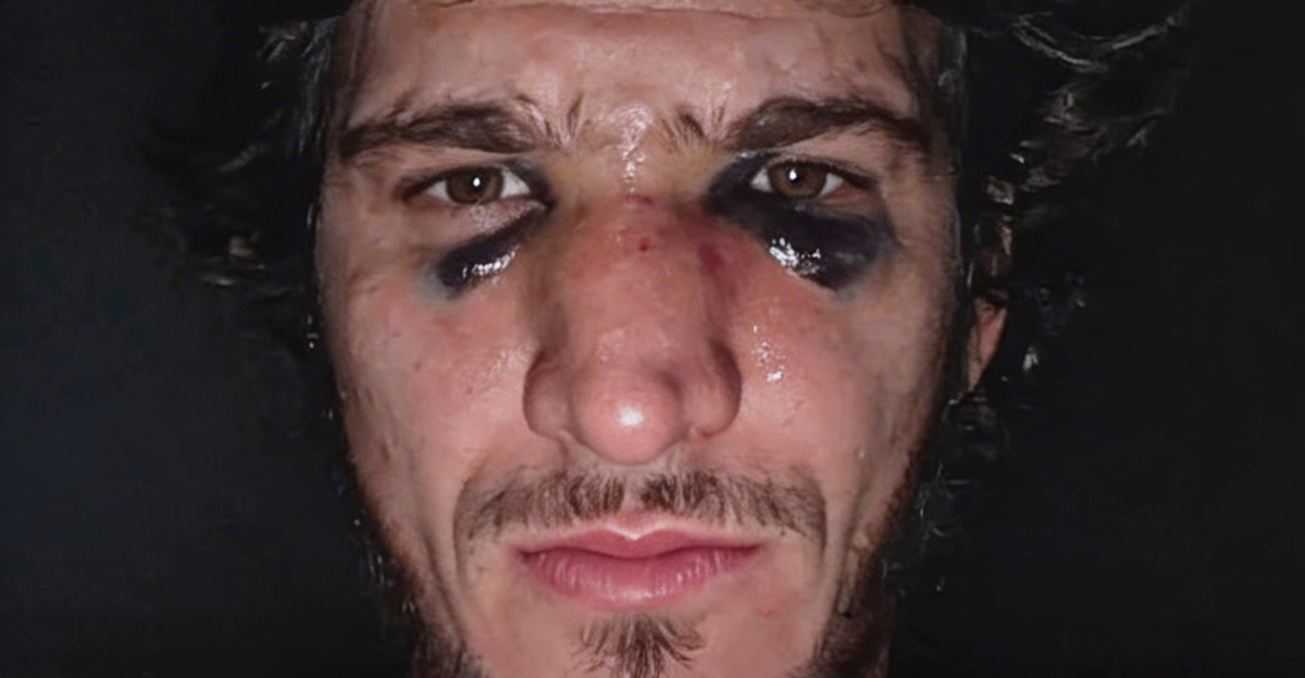 Movsar Evloev broke nose weeks before UFC London win