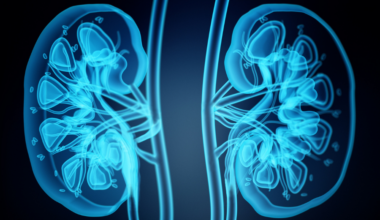 Kidney Transplant System May Miss Chance to Save Lives