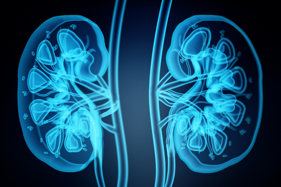 Kidney Transplant System May Miss Chance to Save Lives