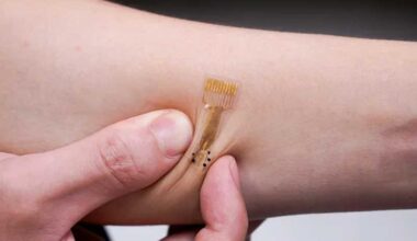 How smart bandage could heal wounds