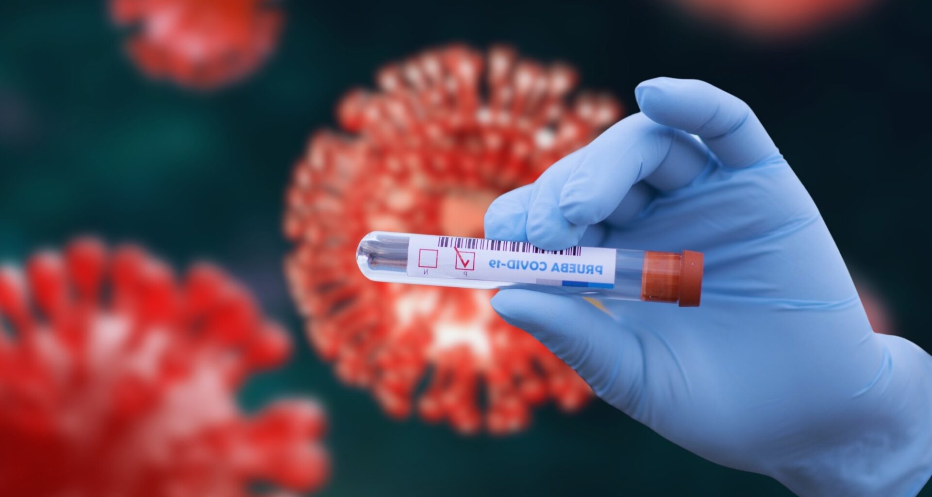 Study: Characterizing persistent Post-COVID-19 vaccination symptoms using MedDRA system organ class and preferred term classifications. Image Credit: moskha.com / Shutterstock