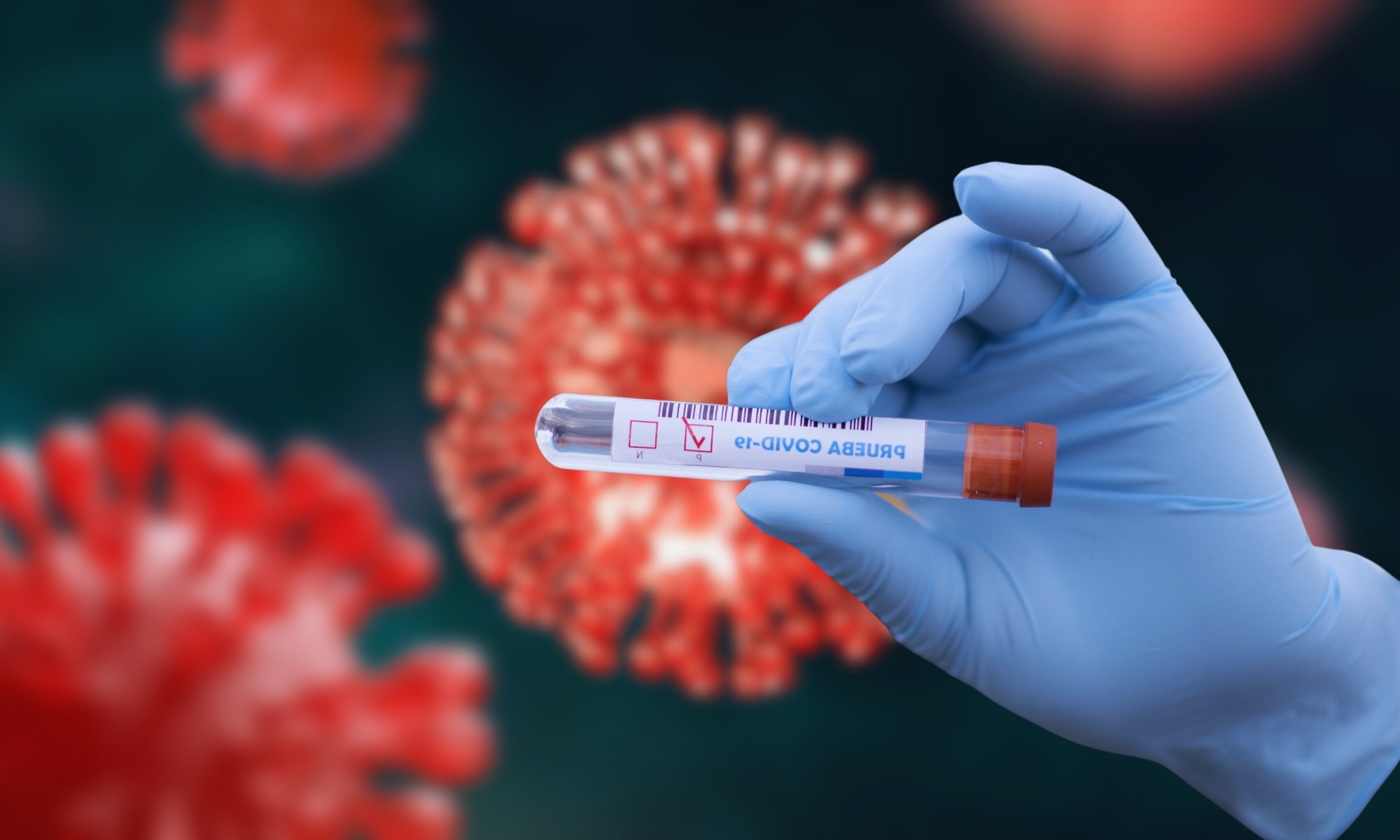 Study: Characterizing persistent Post-COVID-19 vaccination symptoms using MedDRA system organ class and preferred term classifications. Image Credit: moskha.com / Shutterstock