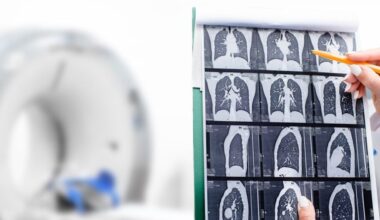 Cancer deaths in under-50s down 44%: JAMA study