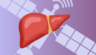 'Mini Livers' May Provide Alternative To Liver Transplant