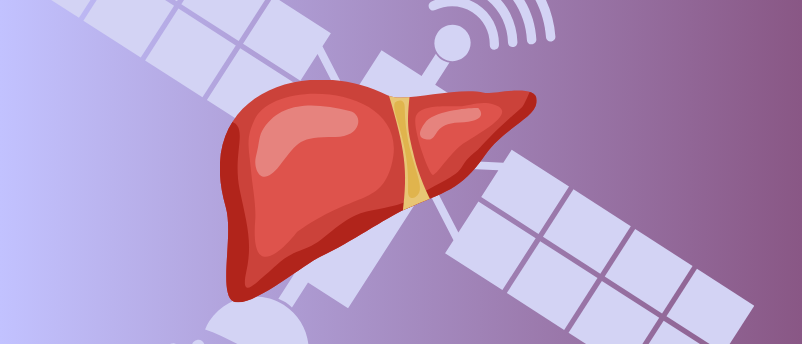 'Mini Livers' May Provide Alternative To Liver Transplant
