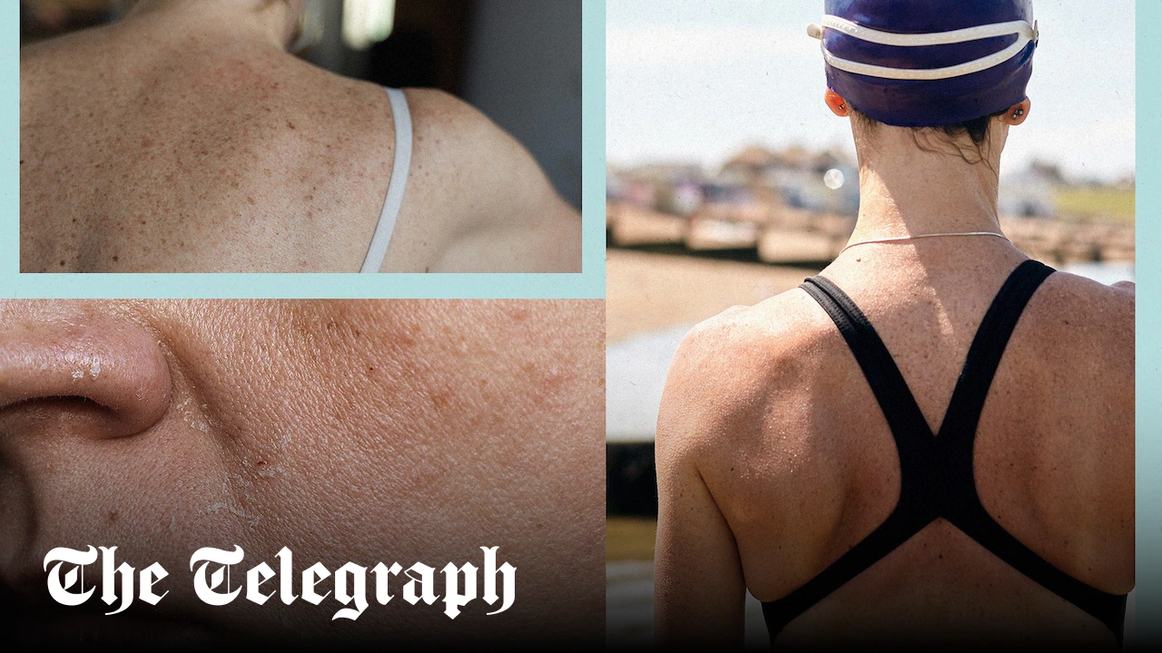 From runner’s face to swimmer’s sunburn: How exercise affects your skin