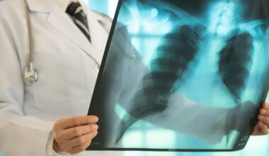 Why Malaysia is losing the war against tuberculosis