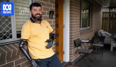 Why Ghanim named his robotic arms after the Peaky Blinders brothers