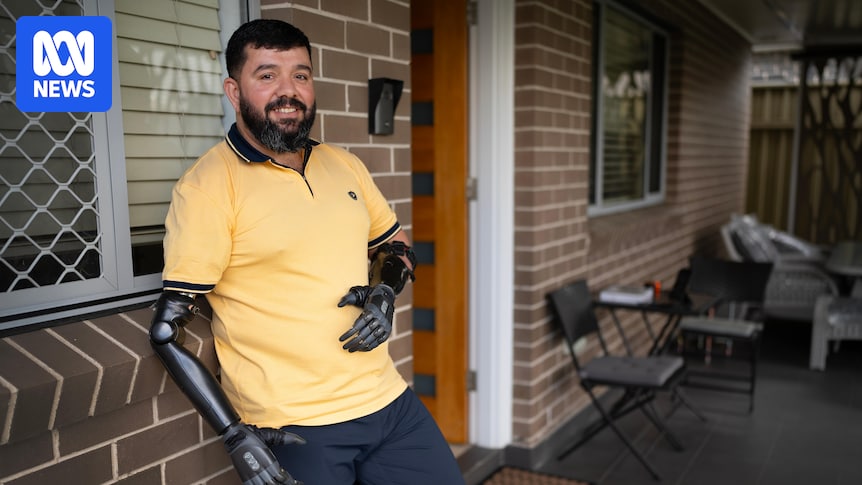 Why Ghanim named his robotic arms after the Peaky Blinders brothers