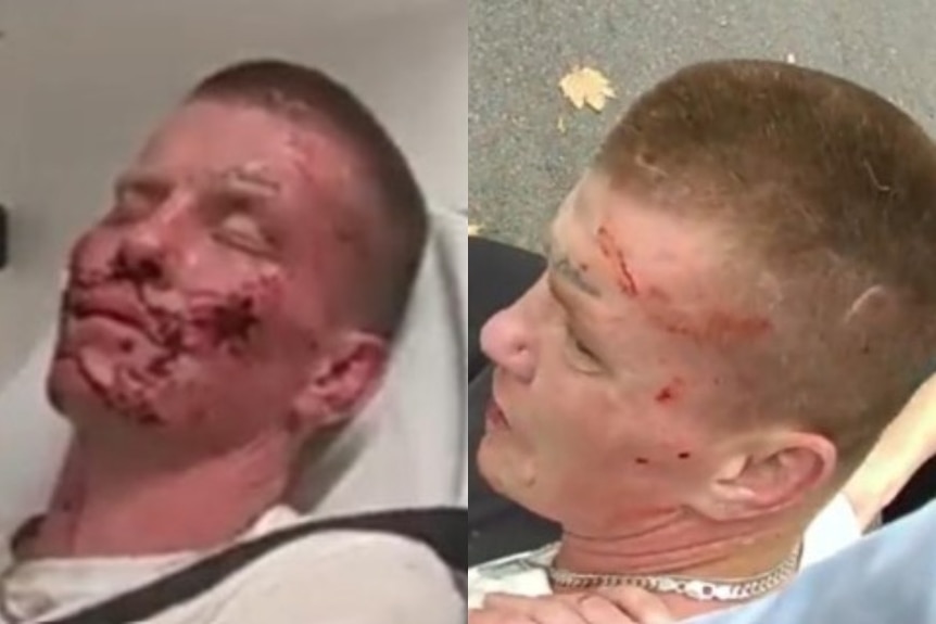 Two photos side by side of a man with blood on his face.
