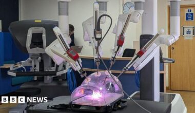 The machine looks like a plastic container with purple light inside, with lots of metal rods poking into it.