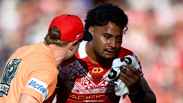 AUCKLAND, NEW ZEALAND - NOVEMBER 02: Eliesa Katoa of Tonga is attended to by a trainer during the Men's Pacific Championships match between the New Zealand Kiwis and Tonga at Eden Park on November 02, 2025 in Auckland, New Zealand. (Photo by Hannah Peters/Getty Images)