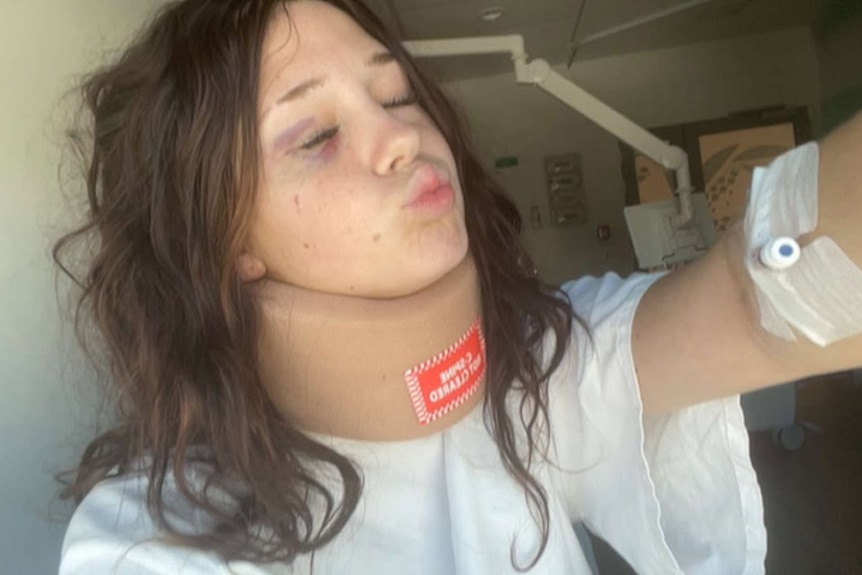 young girl with neck brace and facial bruising makes a pouted face with closed eyes