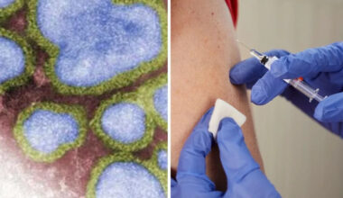 ‘Horror’ flu surge sparks urgent call