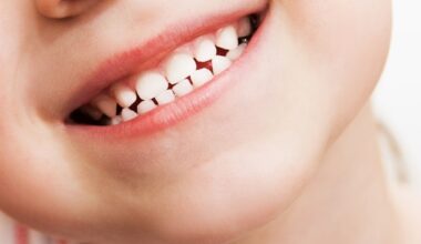 Stem cells from human primary tooth pulp may help treat chronic-phase cerebral palsy