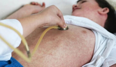 Urgent disease alert for major Aussie city