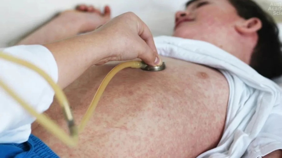 Urgent disease alert for major Aussie city