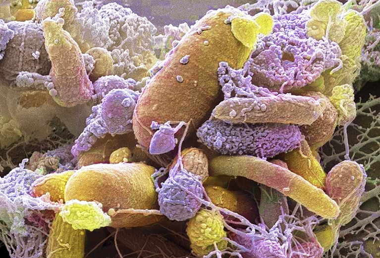 Colour‑enhanced scanning electron micrograph of a mixed community of faecal bacteria. The image shows rod‑shaped and coccoid bacterial cells displayed in false‑colour pastel shades of yellow, pink, purple, and green,to help distinguish morphological features. The cell surfaces exhibit varied textures, including smooth regions, granular deposits, and fibrillar coatings.