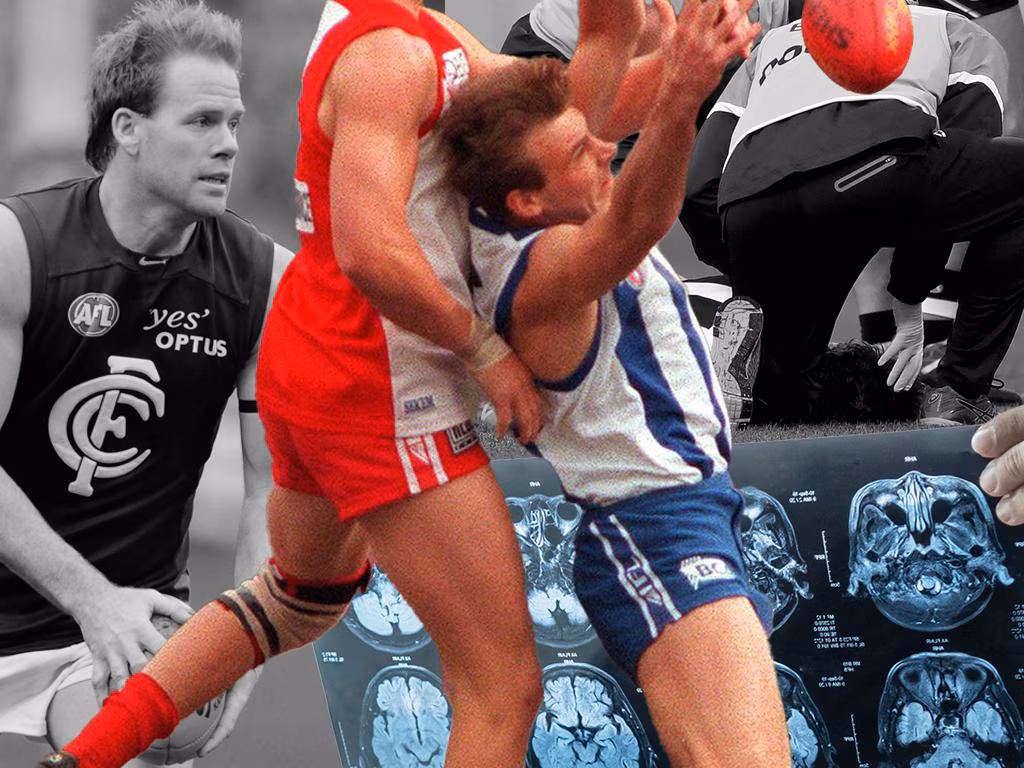 Ten more AFL clubs sued in landmark concussion class action - Herald Sun