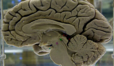 Challenging your brain helps keep it healthy. Here's how to do it