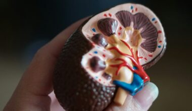 I’m a kidney surgeon. Here’s why I hope I never see you