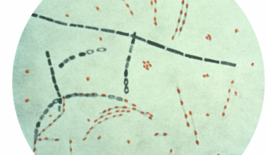 Anthrax-causing bacteria have dwelled in soil for centuries – cycling through people, animals and earth