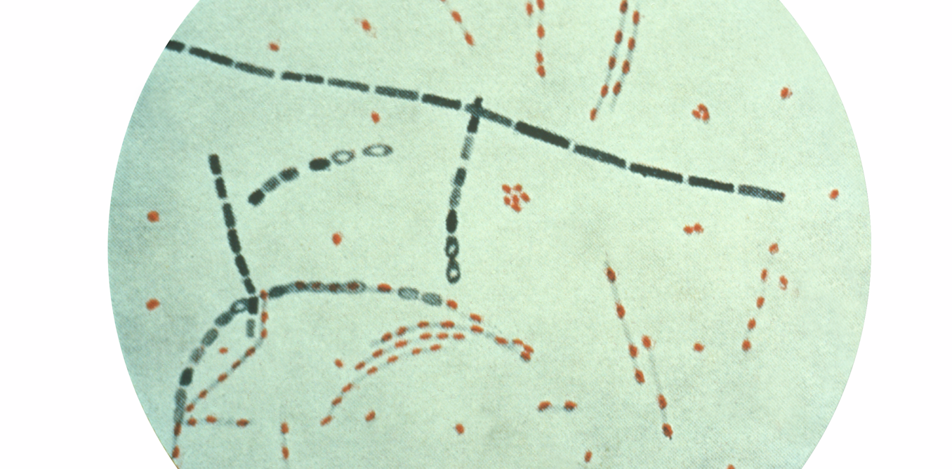Anthrax-causing bacteria have dwelled in soil for centuries – cycling through people, animals and earth