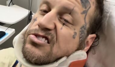 Jelly Roll ATV accident: Jelly Roll breaks collarbone in ATV accident and is seen with neck brace in hospital