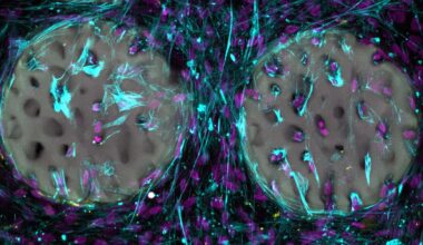 New hydrogel prints bone-like implants at record speed