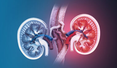 One workout session left man with cola-coloured urine—doctors want you to know why - The South First