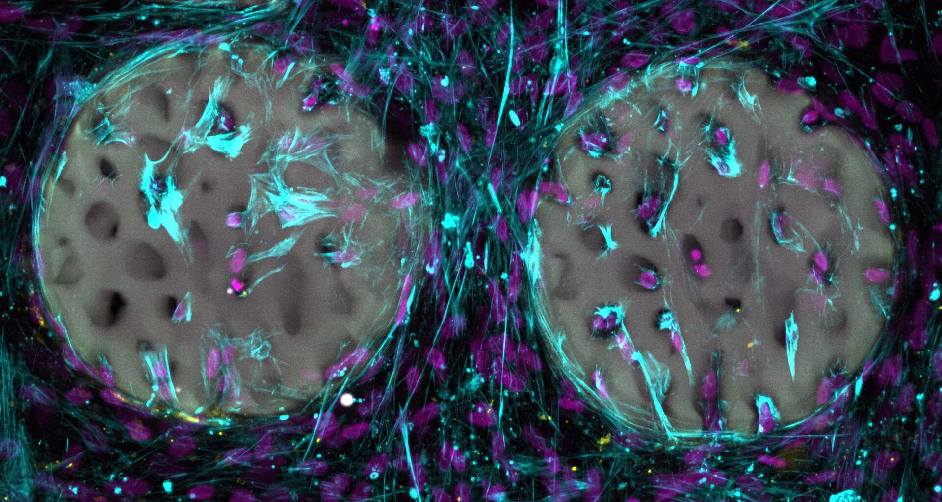 Cross-section of bone, showing bone-forming cells and collagen.