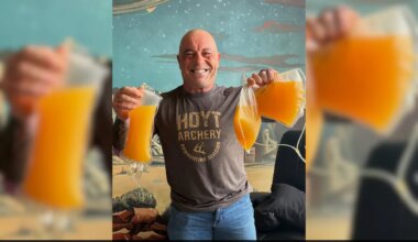 Joe Rogan Gets Plasma Removed From Body, Shares Experience