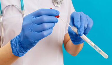 A GP guide to anal cancer screening