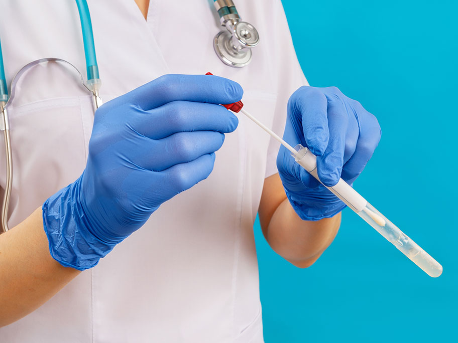 A GP guide to anal cancer screening