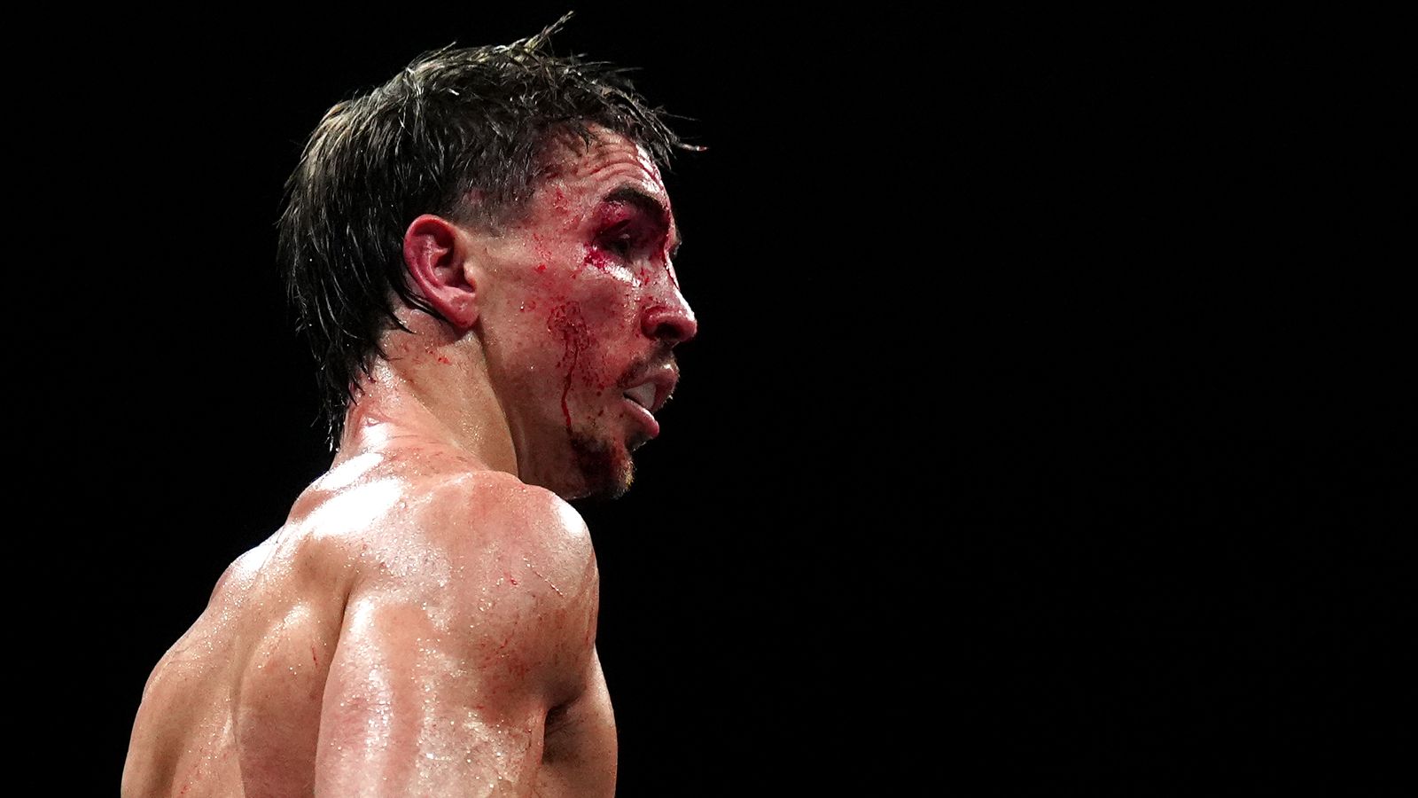 Michael Conlan's title ambitions have suffered a devastating blow.