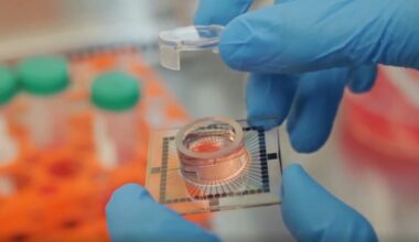 Inside datacenter where day starts with cerebrospinal fluid • The Register