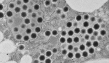 Brighter Side of News