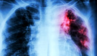 A New Clue Offers Hope Against The Deadliest Infection : ScienceAlert