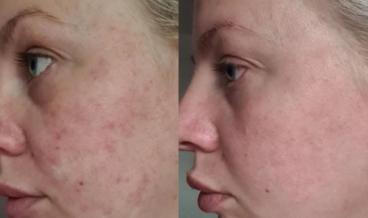 Users have shared their results using Reverse Life