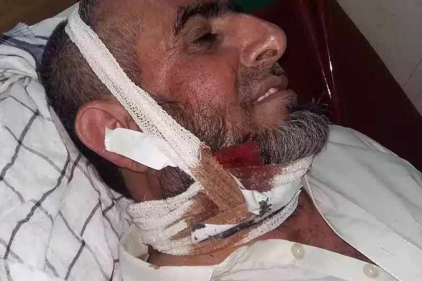 A man with a wound to his chin that's been bandaged up. 