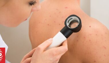 Pharmac funds nivolumab and ipilimumab for melanoma surgery patients