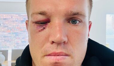 Manly Sea Eagles star Jake Trbojevic can’t see properly, but he has clarity on his future – which could include another season