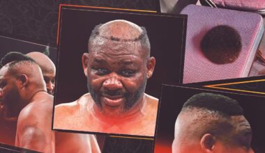 Jarrell Miller and a viral toupee-fueled comeback