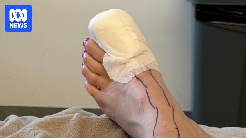 Perth woman warns about pedicure safety after severe infection almost costs her a toe