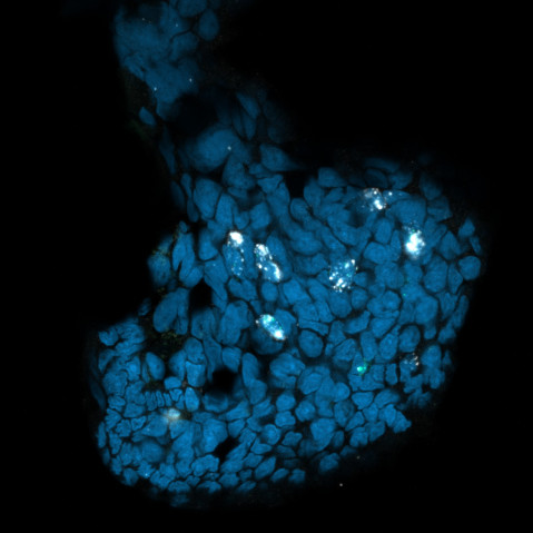 A microscope stain where blue patches reveal the sucker cups and pinpricks of white within the blue patches reveal chemotactile receptors.