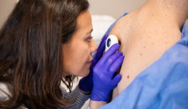 Your gut bacteria could determine your skin cancer risk - but there’s a catch