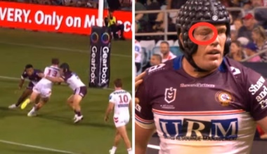 Manly Sea Eagles star Jake Trbojevic suffers eye injury in NRL win over Dragons