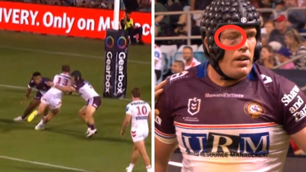 Manly Sea Eagles star Jake Trbojevic suffers eye injury in NRL win over Dragons