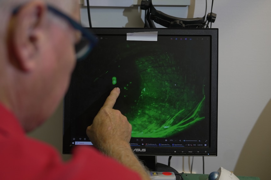 A man points at a computer screen showing a green-scale close-up of an eyeball.