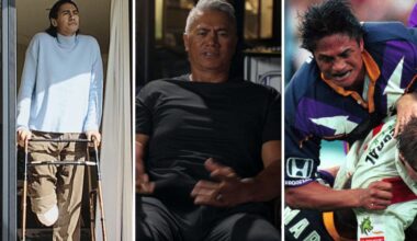 Tawera Nikau leg amputation story, Face 2 Face, Melbourne Storm, New Zealand, motorbike accident